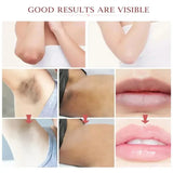 Whitening Cream For Dark Skin Underarm Bleaching Armpit Lightening And Intimate Area Woman Moisturizer Korean Skin Care Products
