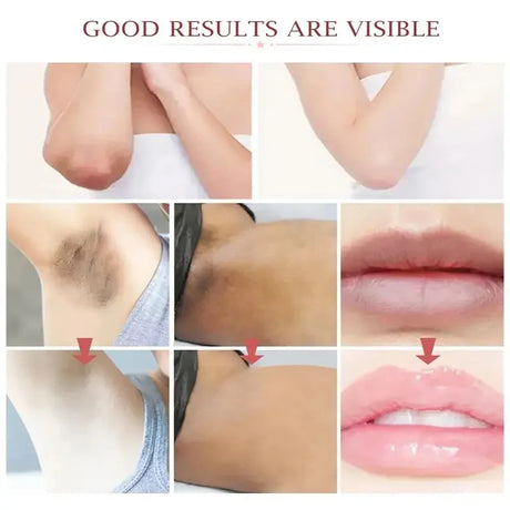 Whitening Cream For Dark Skin Underarm Bleaching Armpit Lightening And Intimate Area Woman Moisturizer Korean Skin Care Products