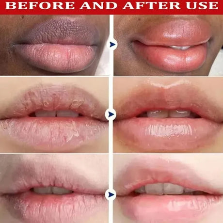Remove Dark Lip Balm Lightening Melanin Mask Gloss Exfoliating
