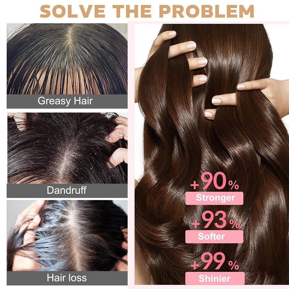250ML Biotin Shampoo For Hair Growth And Thinning Hair – Ginger Shampoo Thickening Formula For Hair Loss Treatment For Women Men