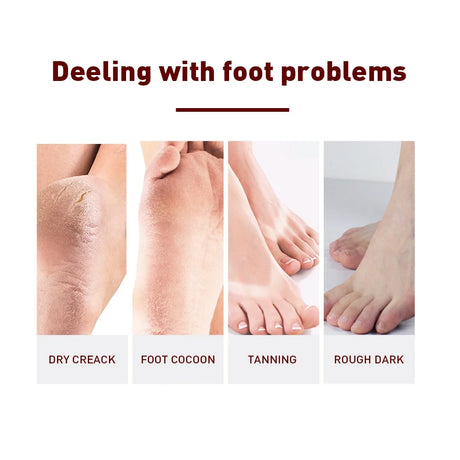 1 Pair Exfoliating Feet Mask Exfoliating Foot Peel Mask Socks Pedicure Peeling Dead Skin Remover Feet Mask Peel Moisturizing