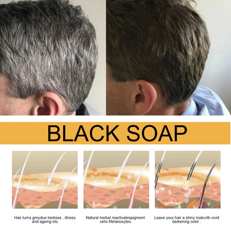 Jaysuing Hair Soap For Scalp Cleansing,Repair Damaged Hair Improve Hair Toughness and Promote Hair Growth Hair Shampoo Soap