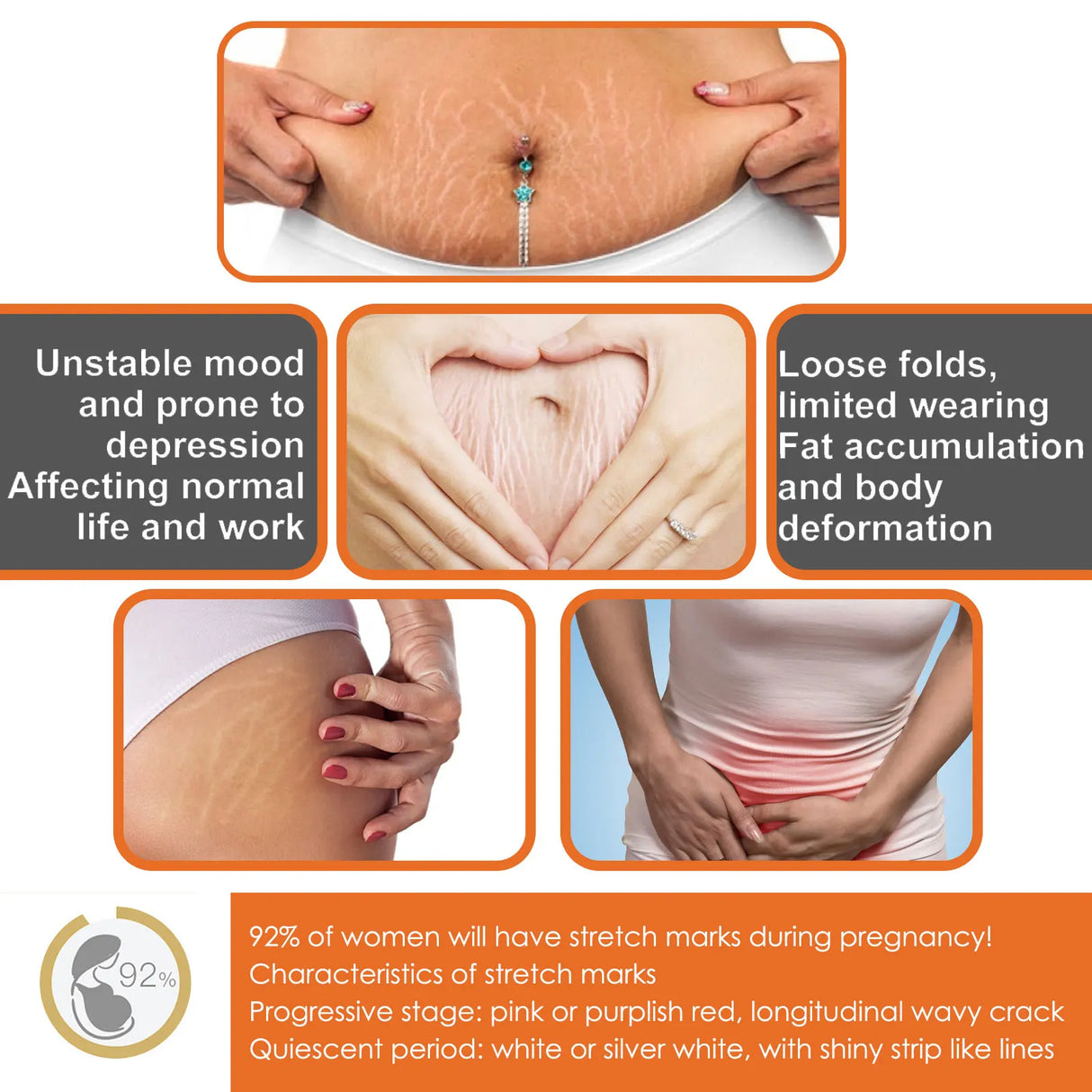 100g Stretch Marks Permanent Removal Cream Maternity Pregnant Women Pregnancy Anti-Winkle Smooth Repair Firming Skin Body Care
