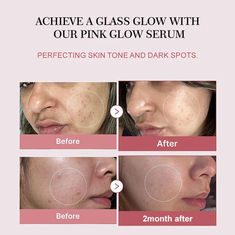 Collagen Peptide Facial Serum for Dull Skin Boosts Elasticity Skin Renewal Repair Salmon PDRN Korean Beauty Product