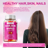 High Potency Biotin Gummies - for Healthy Hair, Skin & Nails, Hair Vitamins for Men & Women | Gluten Free