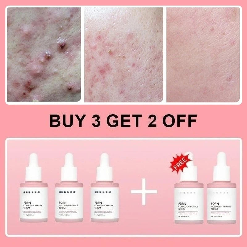 Collagen Peptide Facial Serum Targets Dull Skin Boosts Skin Elasticity Stimulates Skin Renewal Repair Salmon PDRN KOREAN Product