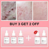 Collagen Peptide Facial Serum Targets Dull Skin Boosts Skin Elasticity Stimulates Skin Renewal Repair Salmon PDRN KOREAN Product