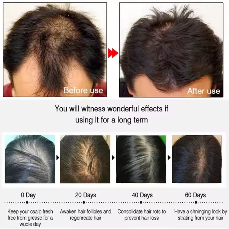 7 Days Fast Batana Oil Hair Growth Serum Anti-loss Hair Regrowth Products Repair Damaged Hair Roots Hair Care For Women Men