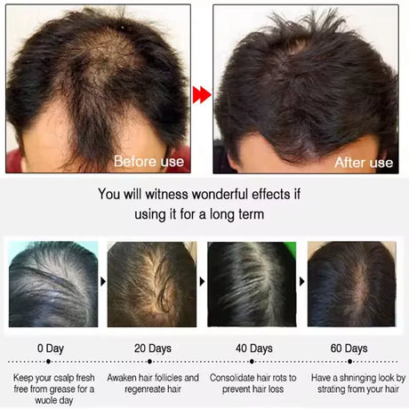 7 Days Fast Batana Oil Hair Growth Serum Anti-loss Hair Regrowth Products Repair Damaged Hair Roots Hair Care For Women Men