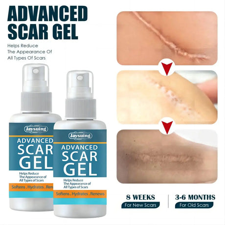 Jaysuing Fade Scar Cream Gel Skin Scar Repair Cream Postpartum Stretch Mark Scar Surgery Smooths Skin