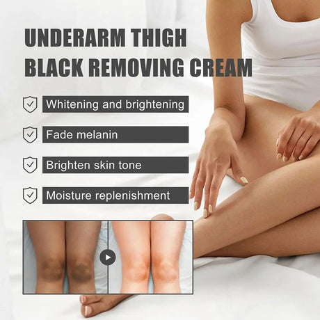 Whitening Underarm Cream For Armpit, Neck, Knees, Elbows, Inner Thigh, Dark Spot Corrector Cream Brightening Natural Skincare