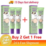 Stretch Marks Repair Cream Fade Lines Improve Duliness Tightness Long-lasting Moisturizing Smooth Enhance Elasticity Body Care