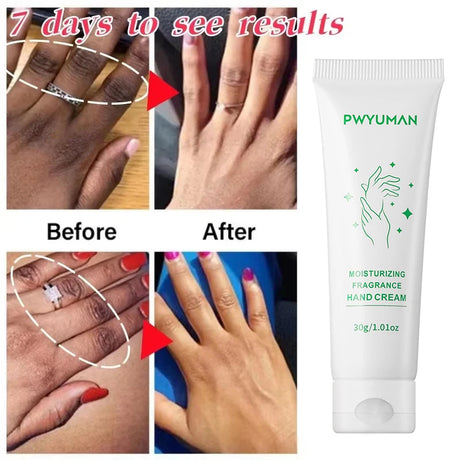 Whitening Cream Private Parts Underarm Bleaching Serum Whiten Butt Knee Brighten Inner Thigh Intimate Parts Dark Remove Melanin