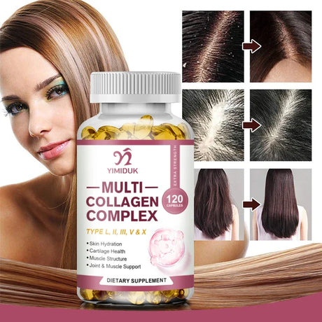 Buy 1 Get 1 Free! Advanced Multi Collagen Complex Supplement, Support Joint Pain Relief, Cartilage Repair & Skin Whitening