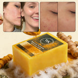 WK JALY Turmeric Lightening Soap Bar, Anti Acne, Dark Spots, With Hyaluronic Acid, Even Skin Tone, For All Skin Types