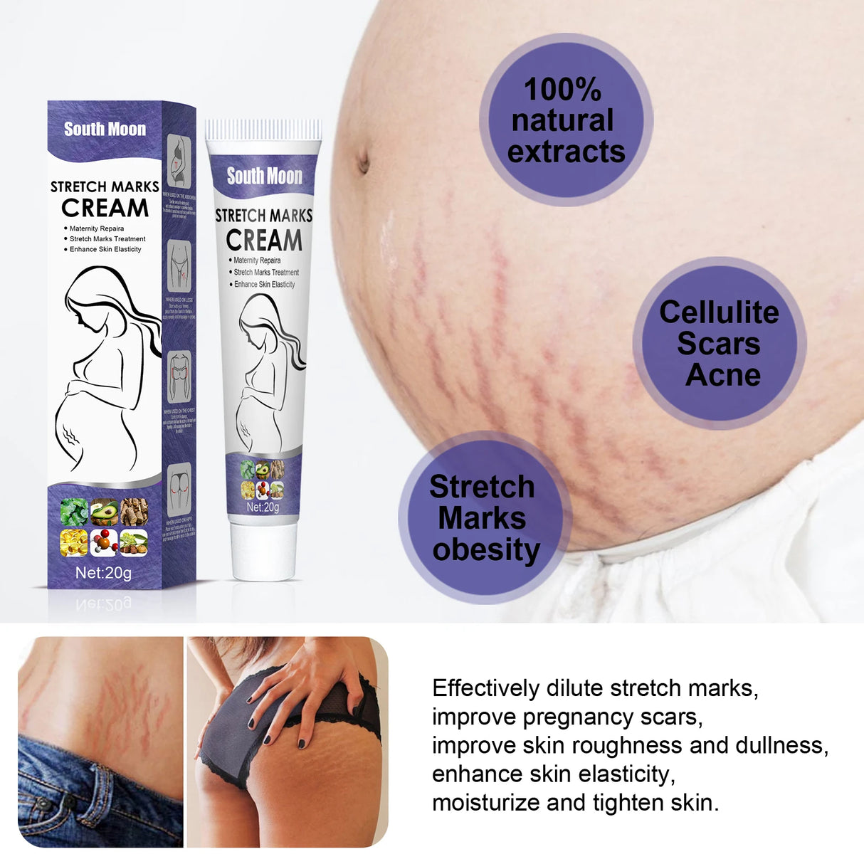 Stretch Marks Permanent Removal Cream Maternity Pregnant Women Pregnancy Anti-Winkle Smooth Repair Firming Skin Body Skin Care