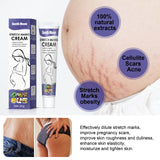 Stretch Marks Permanent Removal Cream Maternity Pregnant Women Pregnancy Anti-Winkle Smooth Repair Firming Skin Body Skin Care