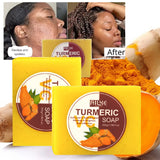 AILKE Natural Turmeric Soap Bar, Brighten, Remove Darkness, Acne, Pimples, Cleaning, Exfoliates, Uneven Skin Tone, 200g