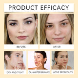 Centella Cleansing Oil Gentle Makeup Remover Oil Deep Pore Cleansing Blackhead Remover Non-Comedogenic Hydrating Oil Cleanser