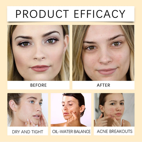 Centella Cleansing Oil Gentle Makeup Remover Oil Deep Pore Cleansing Blackhead Remover Non-Comedogenic Hydrating Oil Cleanser