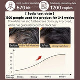 Gray To Black Hair Oil Reduces Premature Graying  Nourishes Follicles Restores Natural Black Pigment Darkening Gray/white Hair