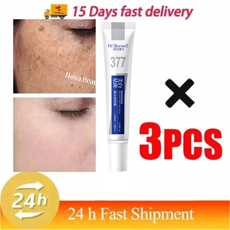 Powerful Spot-Removing Whiten Cream Brighten Skin Fast Eliminates Melanin Pigmentation Melasma Dark Spots Korean Face Skin Care