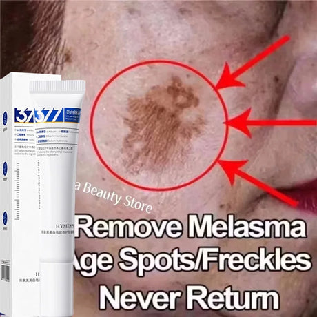 Powerful Spot-Removing Whiten Cream Brighten Skin Fast Eliminates Melanin Pigmentation Melasma Dark Spots Korean Face Skin Care