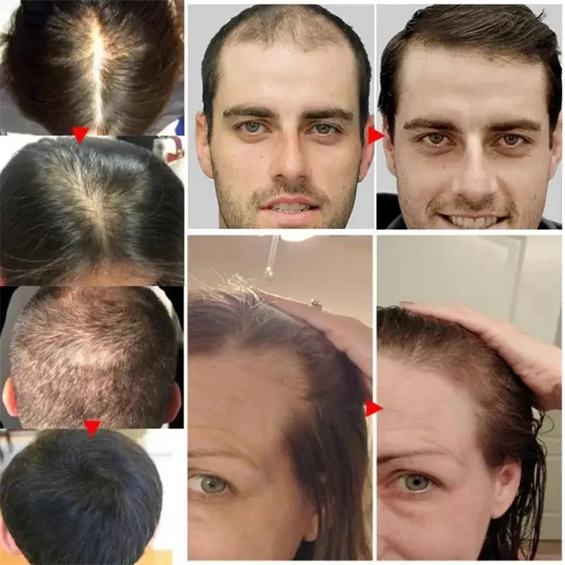 7 Days Fast Batana Oil Hair Growth Serum Anti-loss Hair Regrowth Products Repair Damaged Hair Roots Hair Care For Women Men