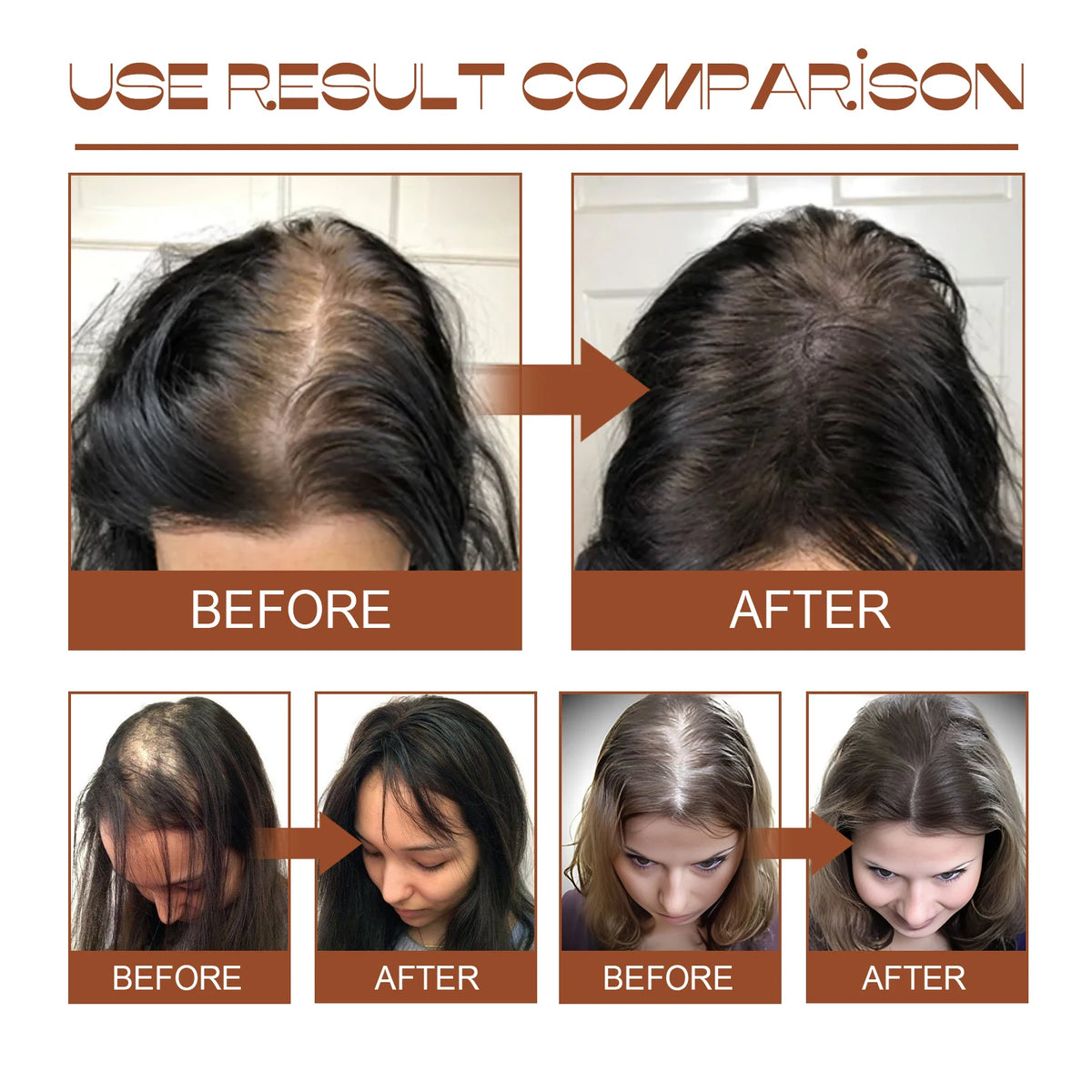 100% Pure Organic Hair Mask Batana Oil Hair Growth Oil Natural Treatment Nourish Reduce Hair Loss Anti-Breakage