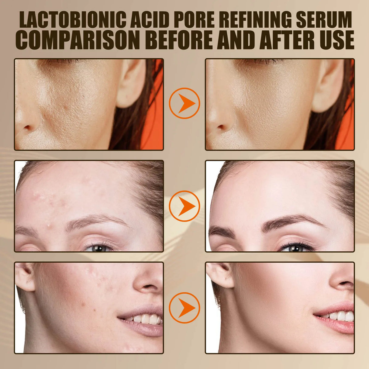 EELHOE Lactobionic Acid Pore Shrink Face Serum Skin Repair Remove Blackheads Acne Skin Care Lasting Moisturizing Korean Cosmetic