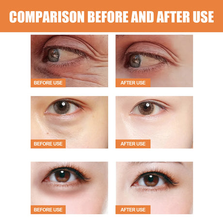 Vitamin C Eye Cream Nourishing Remove Dark Circles Fade Fine Lines Enhance Skin Elasticity Glowing Eye Skin Cream