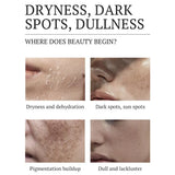 1/2/3PCS Dark Spots Removal Cream Facial Whitening Freckle Acne Mark Pigmentation Removal Melanin Skin Correction Care
