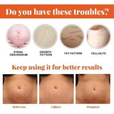 Stretch Mark Vanishing Cream Remove Body Buttock Breast Marks Effective Repair Maternity Loose Firming Skin Care