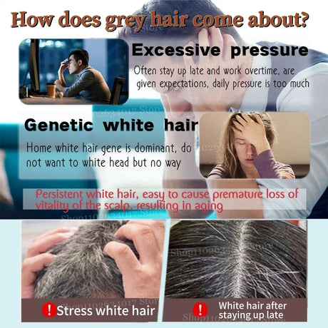 Gray To Black Hair Oil Reduces Premature Graying  Nourishes Follicles Restores Natural Black Pigment Darkening Gray/white Hair