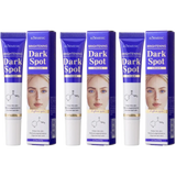 1/2/3PCS Dark Spots Removal Cream Facial Whitening Freckle Acne Mark Pigmentation Removal Melanin Skin Correction Care