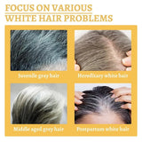 Gray White Hair Treatment Shampoo White To Black Anti Gray Hair Beard Dye Anti Loss Repair Nourish Hair Care Products Men Women