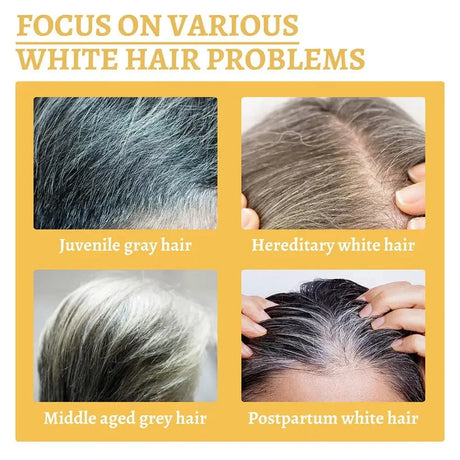 Gray White Hair Treatment Shampoo White To Black Anti Gray Hair Beard Dye Anti Loss Repair Nourish Hair Care Products Men Women