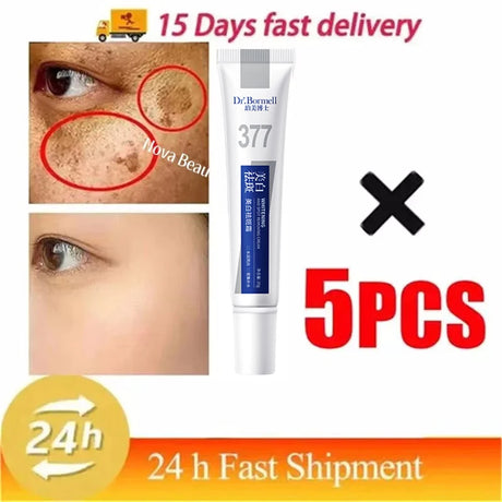 Powerful Spot-Removing Whiten Cream Brighten Skin Fast Eliminates Melanin Pigmentation Melasma Dark Spots Korean Face Skin Care