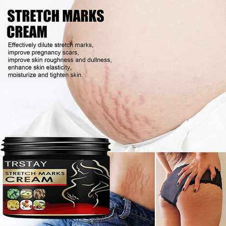 TRSTAY Stretch Mark Cream for Pregnancy Skin Replenish And Repair Cell Growth Promotion Maternity Striae Gravidarum Care