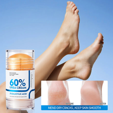Two-Piece Set Includes 60% Urea Hydrating Foot Cream and Body Cream for Dry Cracked Hands and Heels with 2% Salicylic Acid Foot Care