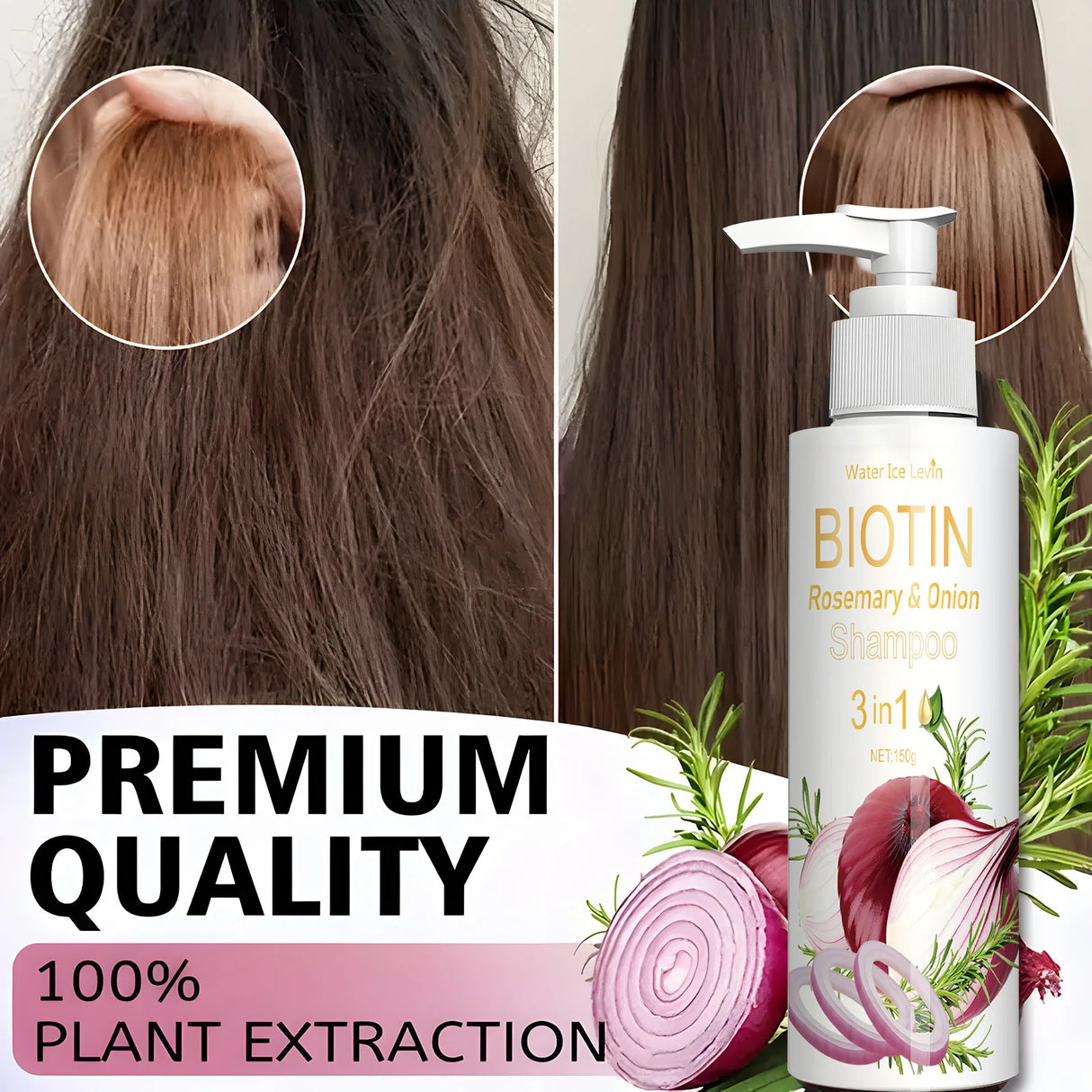 Daily Use Biotin Onion Rosemary Shampoo Gentle Mild Formula Clean Scalp Impurities Support Long Term Healthy Hair Growth 150g
