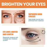 Vitamin C Eye Cream Nourishing Remove Dark Circles Fade Fine Lines Enhance Skin Elasticity Glowing Eye Skin Cream