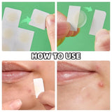 24PCS Microneedle AcnePatch Painlessly Penetrate Acne Patches Blemishes Pimples Covering Patch Daily Unisex Skincare