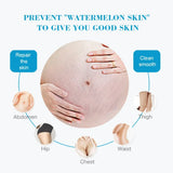 Snail Removes Stretch Mark Cream To Remove Postpartum Obesity Pregnant Women Repair Anti-Aging Anti-Winkles Firming Body Cream