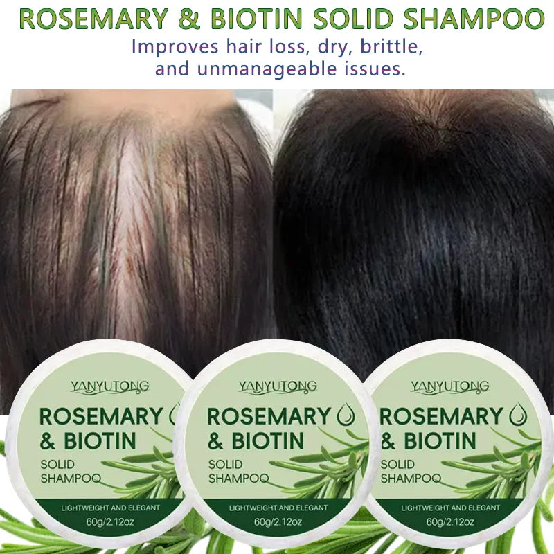 Rosemary Shampoo Soap: Deep Cleansing, Moisturizing and Nourishing, Scalp Relief and Oil Control, Hair Growth and Care, Daily Sh