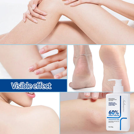 Two-Piece Set Includes 60% Urea Hydrating Foot Cream and Body Cream for Dry Cracked Hands and Heels with 2% Salicylic Acid Foot Care