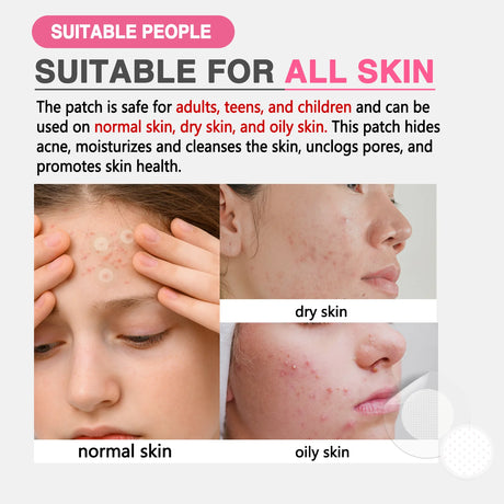GROEI 18Pcs Microneedle Acne Patches Pimple Invisible Beauty Concealer Blemish Treatment Deep Clean Pores Overnight Recovery