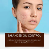 Pimple Acne Treatment Face Cream Oil Control Nourish Balance Refreshing Repairing Pimple Remover Acne Removing Cleansing Cream