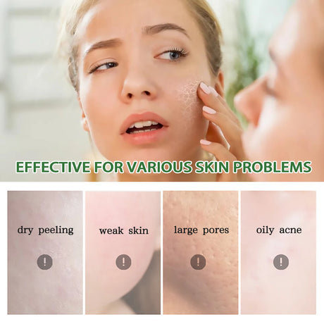 Aloe Vera After Sun Repair Cream,Triple Threat Damage Control,Instant Cooling&Redness Banisher,Cell Plumping&Rehydration,Anti Sun Spot&Brightening Power,Flawless Tan Extender,Collagen Recovery Booster,Ultra Lightweight Hydro