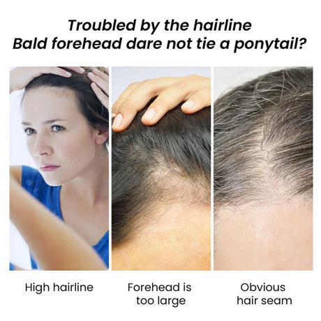 Eelhoe Jojoba Oil Hair Growth Serum Reduce Loss Scalp Treatment More Thicker Keep Regrowth Oil Control Hair Nourish Essencial Oi